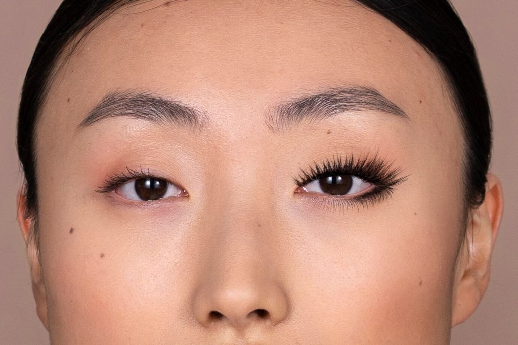 誰適合進行雙眼皮手術